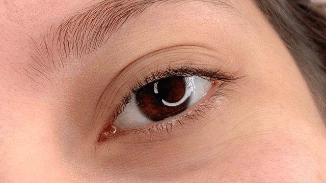 eye before